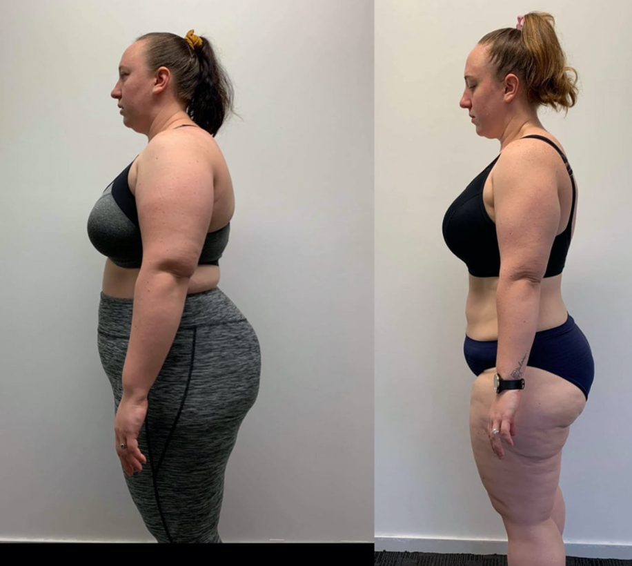 Céline avant après